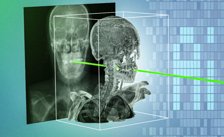 New AI technique could make minimally invasive surgeries safer and more precise | MIT News